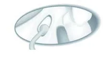 Набор насадок Satelec (Acteon) Sinus Lift Kit (SL1, SL2, SL3, SL4, SL5) для Piezotome CUBE/Solo (LED) 2/Piezotome 2/Implant Center 2 f87519 11