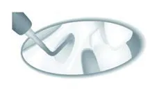 Набор насадок Satelec (Acteon) Sinus Lift Kit (SL1, SL2, SL3, SL4, SL5) для Piezotome CUBE/Solo (LED) 2/Piezotome 2/Implant Center 2 f87519 15